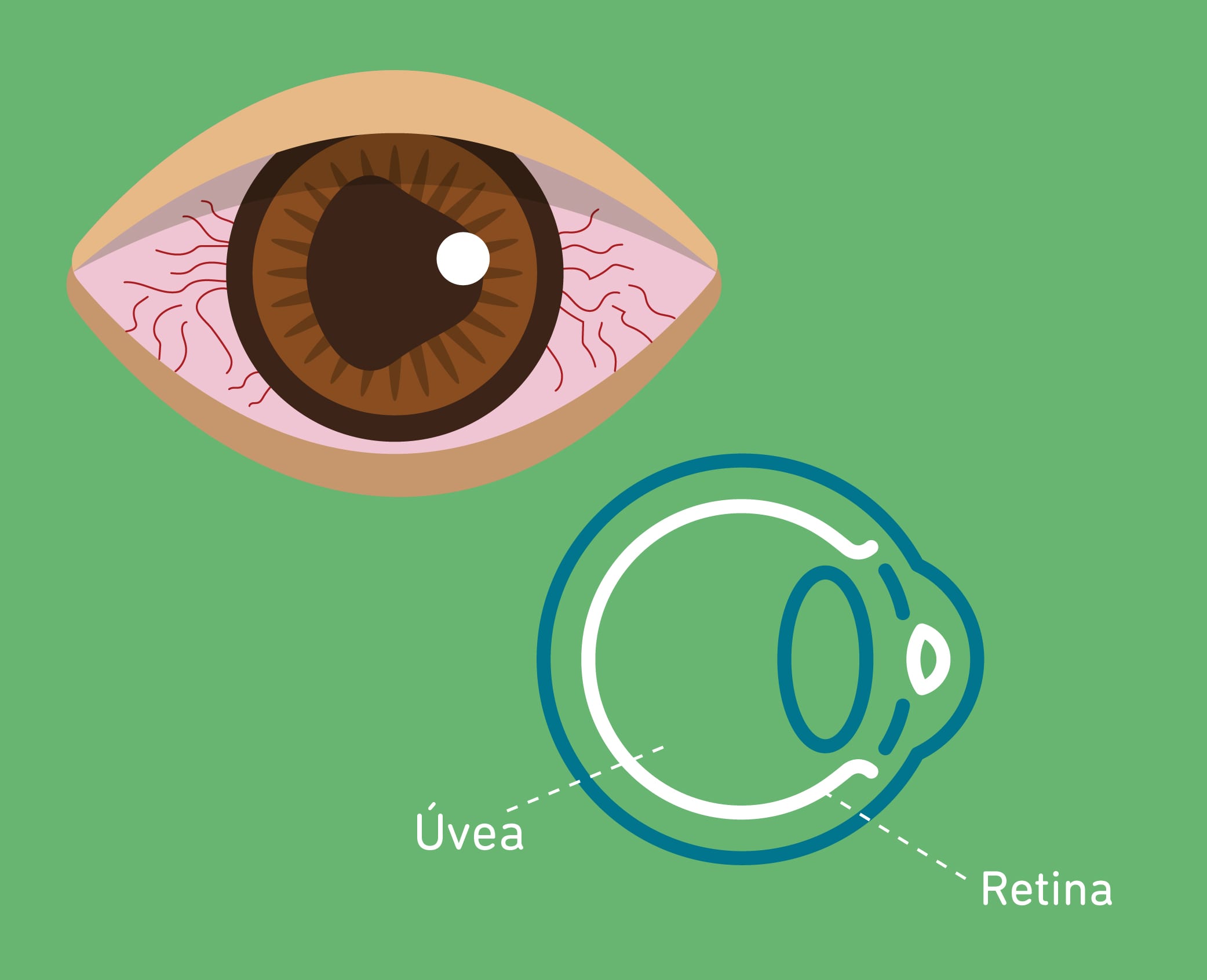 Uveítis ¿qué Es Síntomas Y Tratamientos Salauno