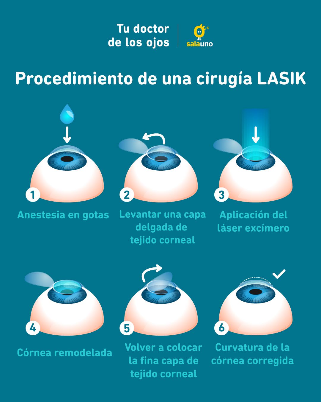 Pagar tributo Australia Reducción LASIK: Cirugía Láser, dile ¡adiós a los lentes! - salauno