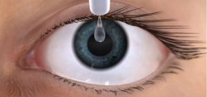 Ojo seco, aplicación de gotas como tratamiento para la sequedad ocular
