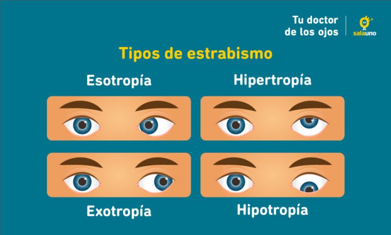 Estrabismo: Síntomas, Causas Y Tratamiento - Salauno