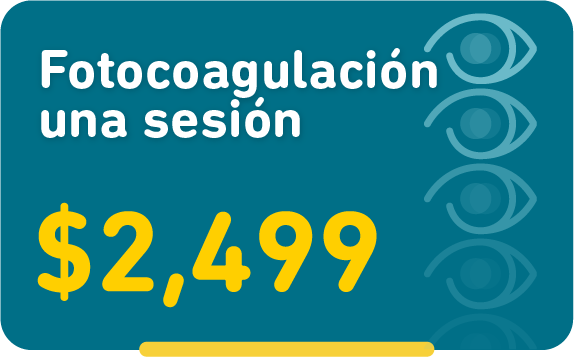 Fotocoagulación una sesión