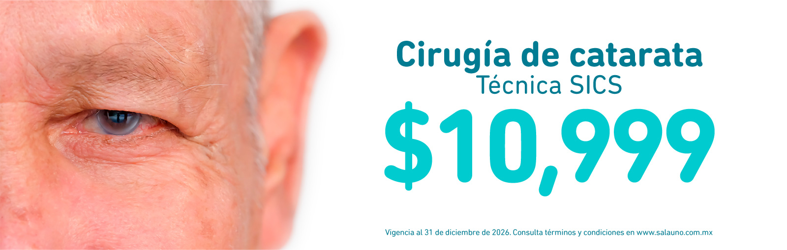 Cirugia de Catarata